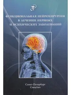 Функциональная нейрохирургия в лечении нервных и психических